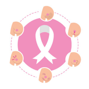 Graphic showing different signs to look out for in your breasts for breast cancer awareness month blog